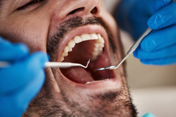 Emergency Dentist Open Today in MD